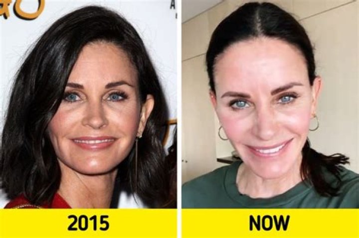 Candice Delong Plastic Surgery Botox & Facelift? [REVEALED]