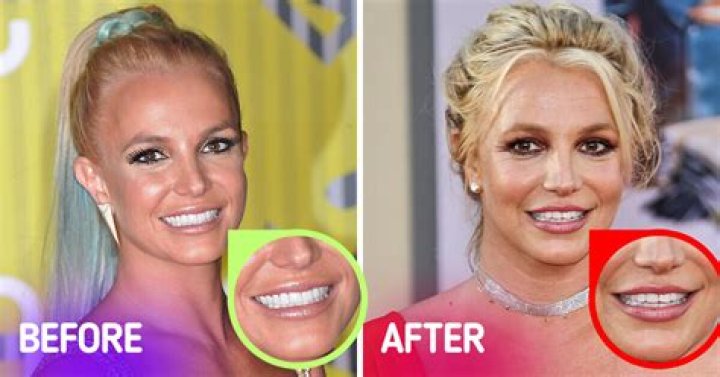 Discover Britney Spears' Teeth Gap: Unlocking The Secrets Of Her Iconic Smile