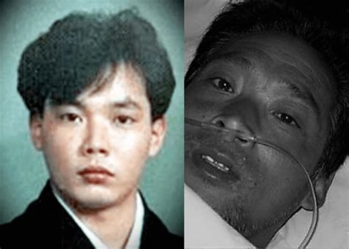 Hisashi Ouchi: The Man Behind The Real Photos From The Hospital