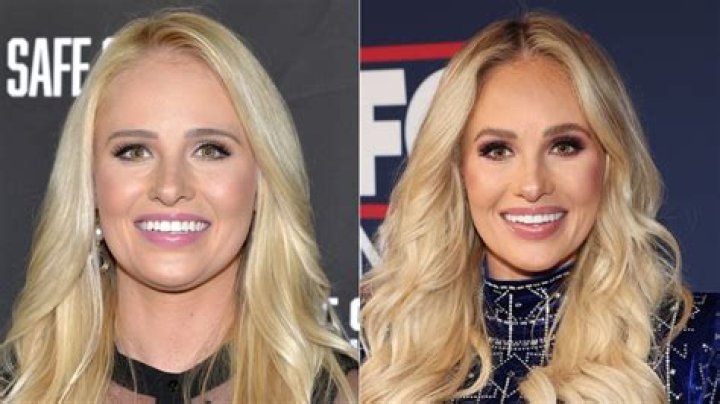Unveiling Tomi Lahren's Weight Loss Journey: Secrets, Tips, And Astonishing Results